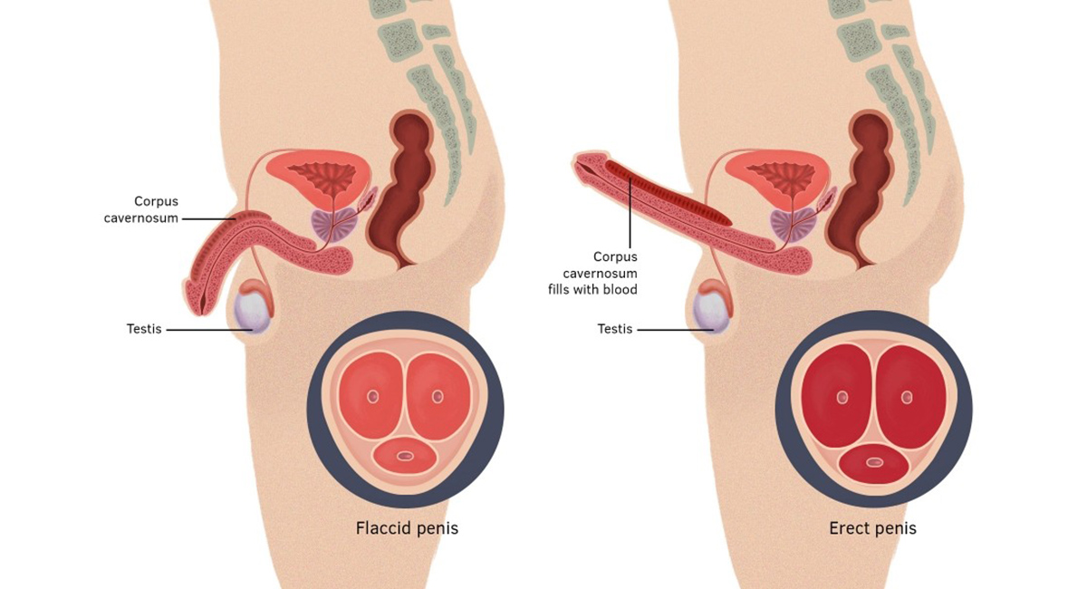 Erectile Dysfunction